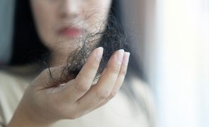 queda de cabelo na infancia